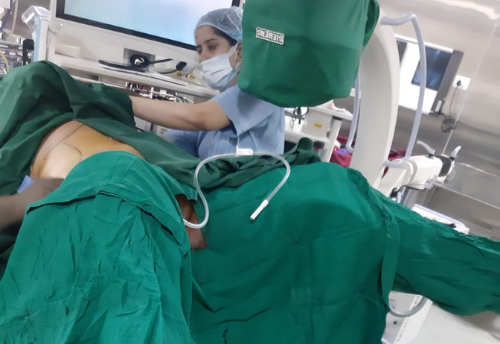 Percutaneous Cysto Lithotripsy for kidney stone removal